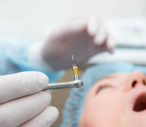 Up-close view of dental implant and patient undergoing surgery