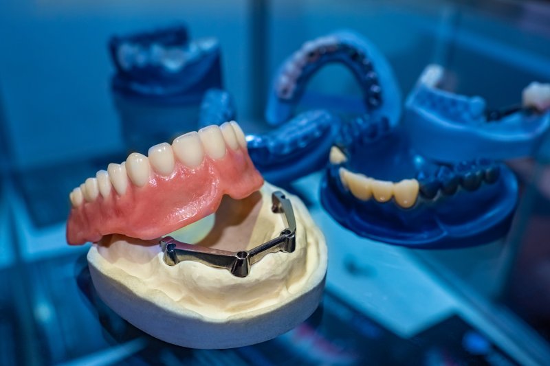 set of removable implant dentures   